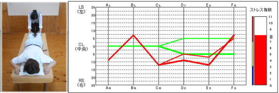 �X�g���X�v��